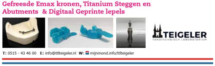 Gefreesde Emax kronen, titanium steggen en meer