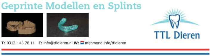 Geprinte modellen en splints