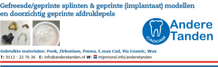 Gefreesde - Geprinte splinten - (implantaat) modellen - afdruklepels