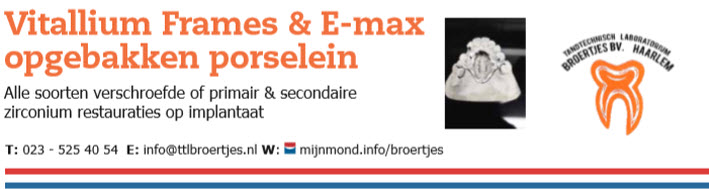 Vitallium Frames & E-max opgebakken porselein