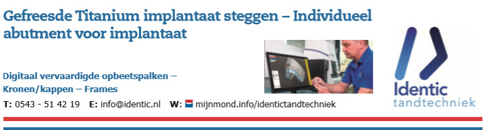 Gefreesde Titanium implantaat steggen