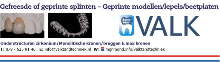 Gefreesde of geprinte splinten - Geprinte modellen/lepels/beetplaten